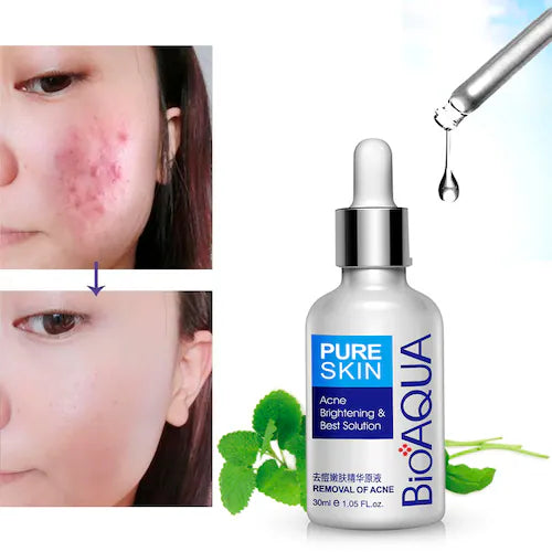 BIOAQUA ® | SERUM FACIAL ANTIACNÉ